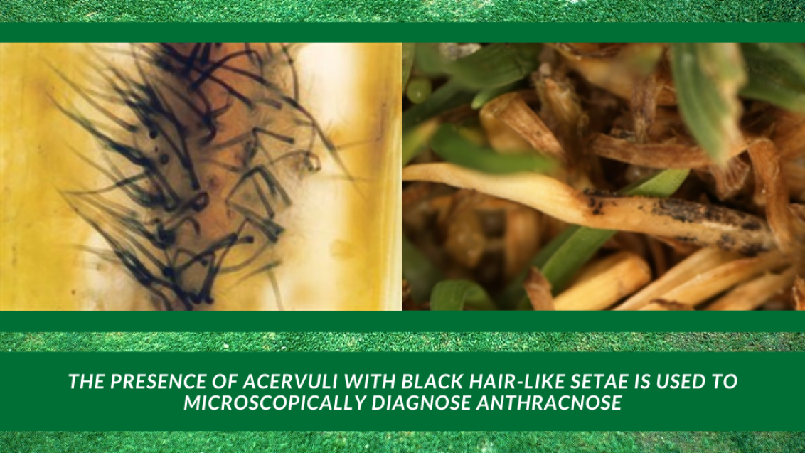 Anthracnose diagnosis